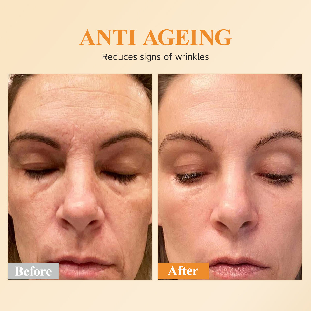 Suero de Vitamina C HKH para la Cara: 48 Cápsulas Suero Reparador de Arrugas Anti-Envejecimiento con Retinol - Aceite de Vitamina E y Niacinamida para Mujeres - Cuidado Profundo Diario de la Piel para Alisar, Hidratar y Iluminar Líneas Finas