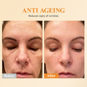 Suero de Vitamina C HKH para la Cara: 48 Cápsulas Suero Reparador de Arrugas Anti-Envejecimiento con Retinol - Aceite de Vitamina E y Niacinamida para Mujeres - Cuidado Profundo Diario de la Piel para Alisar, Hidratar y Iluminar Líneas Finas