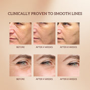 Cápsulas de Suero de Retinol Bakuchiol HKH: 30 Dosis Única de Suero Antienvejecimiento para Arrugas con HPR y Vitamina C para Mujeres de 25 a 55 Años - Mejora Arrugas y Manchas Oscuras - Reafirmante, Suavizante e Hidratante - Amigable para Viajes