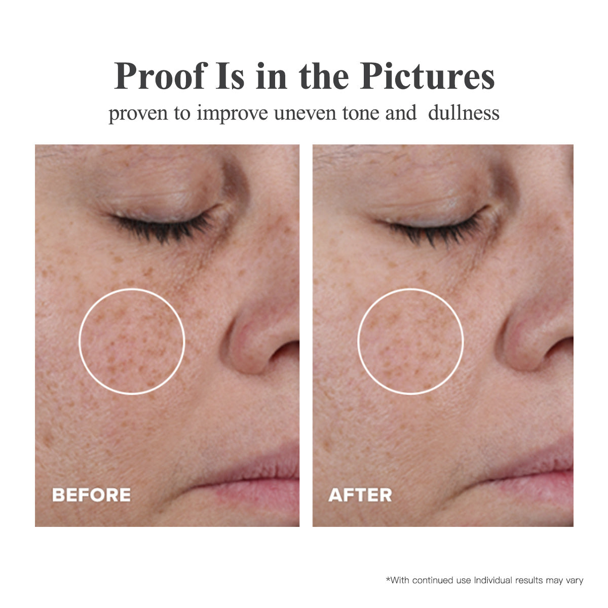 Cápsulas de Suero de Triple Vitamina C para la Cara: Corrección de Manchas Oscuras con Camelia Niacinamida VE Suero Antienvejecimiento para Mujeres - 28 Cápsulas para Tensar la Piel Flácida y las Líneas Finas